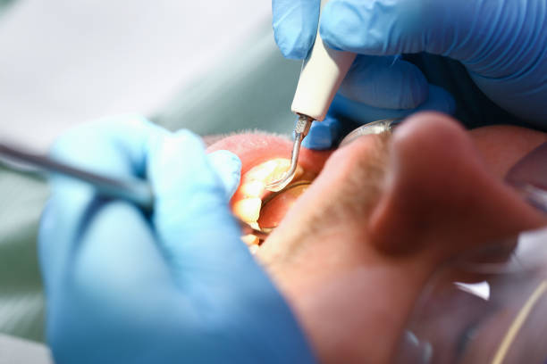 Best Emergency Treatment for Toothache in Arkwright, SC