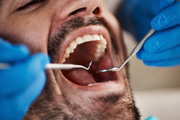 Best Emergency Wisdom Teeth Removal in Arkwright, SC
